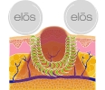 Cellulite_Treatment